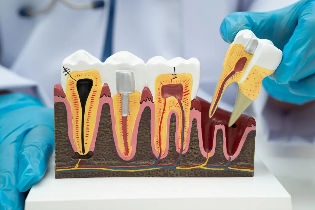 A tooth model showing the inside of a tooth and its root canals