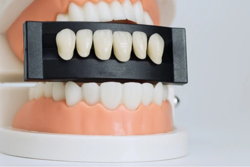 Bridges at BeauDent Family Dental in Beaumont